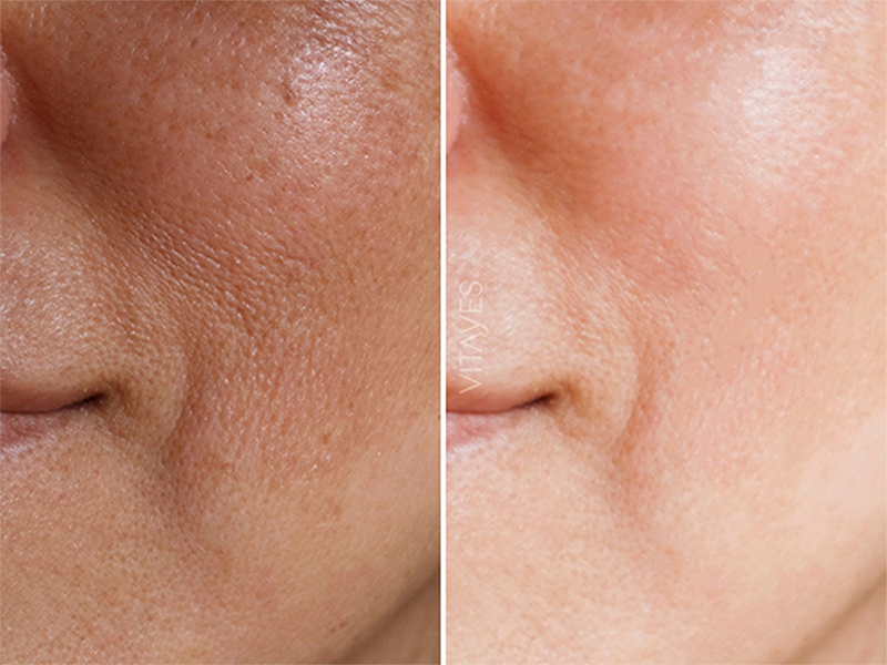 Perfector Vitamin C 10% Serum – Mit Hyaluron 30 ml