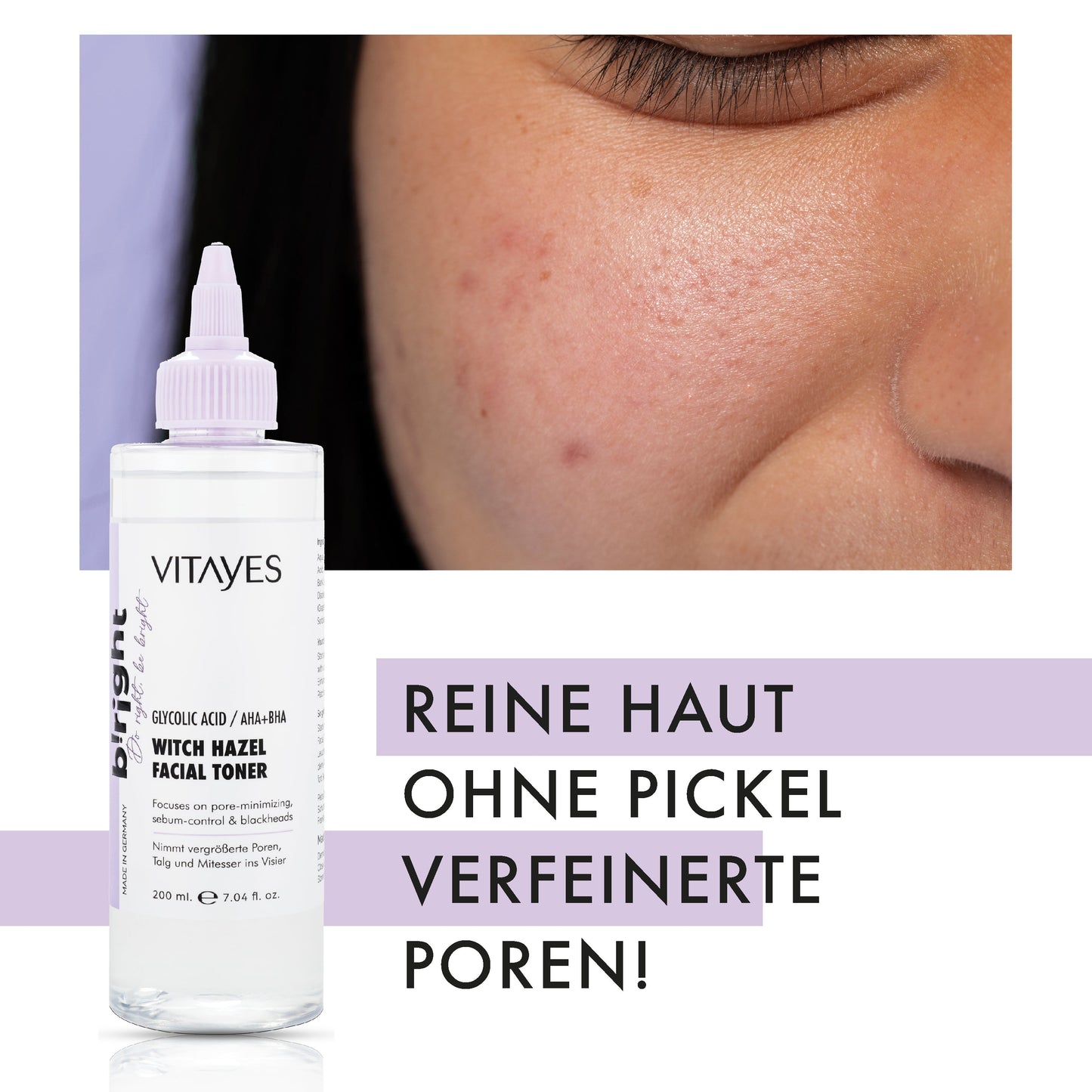 AHA/BHA Gesichtswasser – Porenverfeinernde Tiefenreinigung mit Glycolsäure & Hamamelis 150 ml